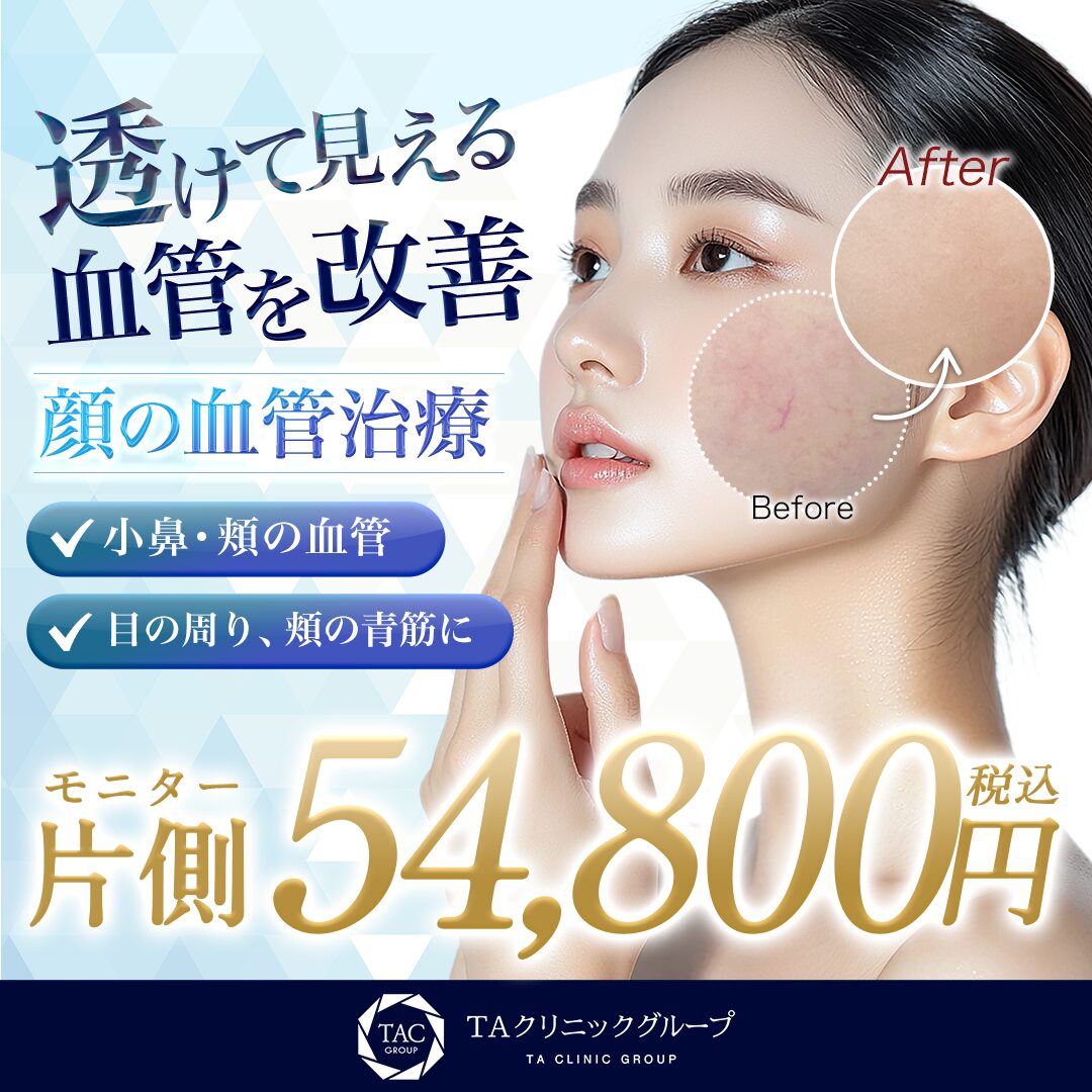 顔の血管治療_モニター募集
