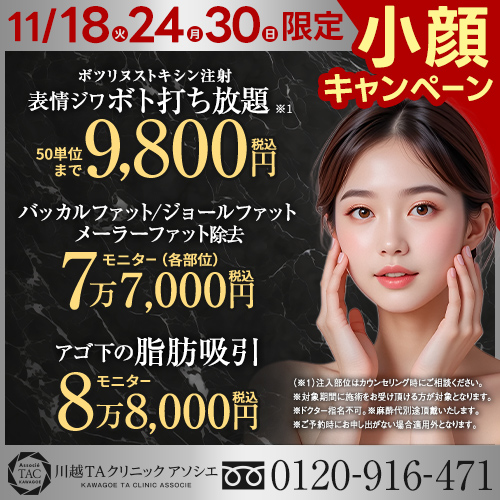 川越_小顔キャンペーン_表情ジワボトックス打ち放題_顔の脂肪除去・吸引